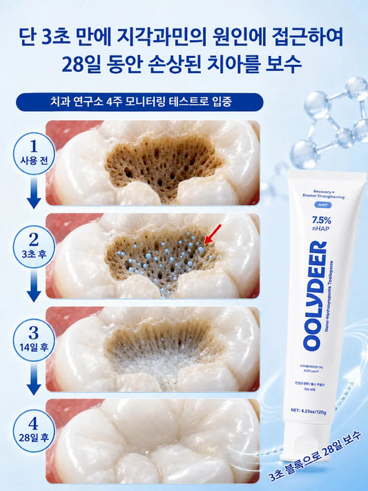 【프로페셔널 치아 보호】7.5% 하이드록시아파타이트 치약