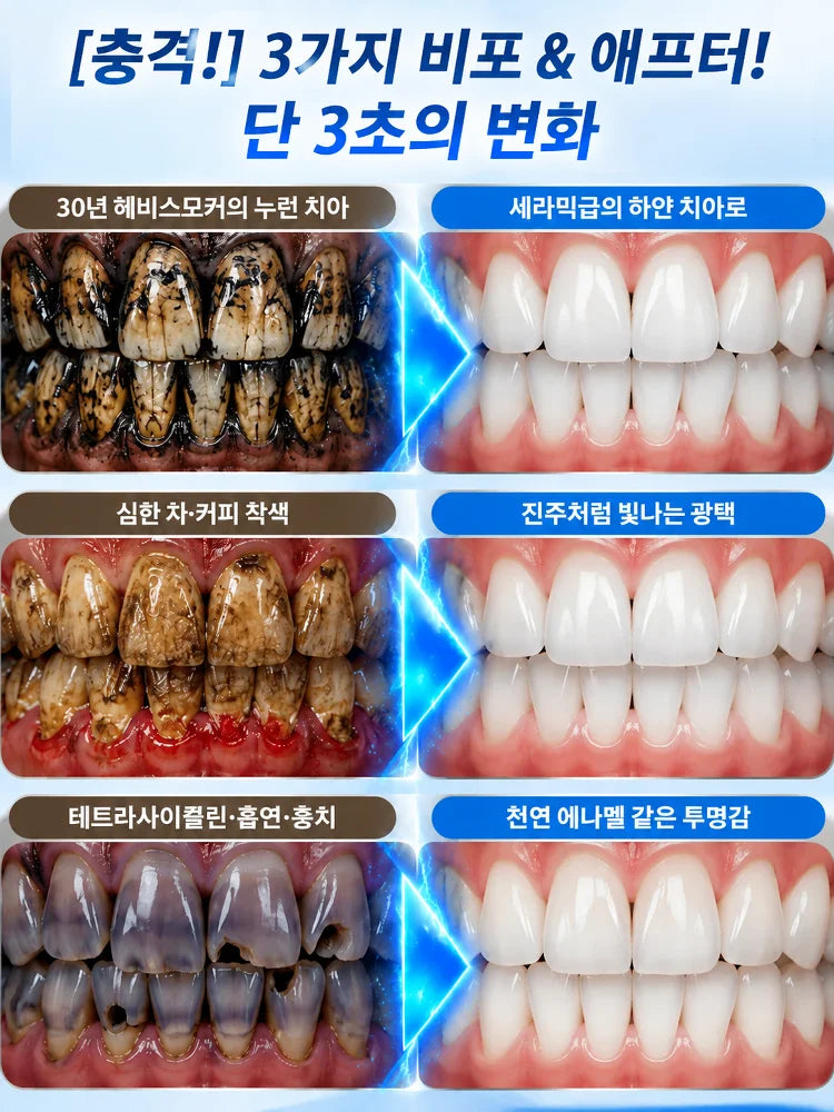 【프로페셔널 치아 보호】7.5% 하이드록시아파타이트 치약