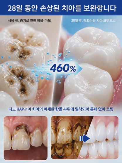 【프로페셔널 치아 보호】7.5% 하이드록시아파타이트 치약
